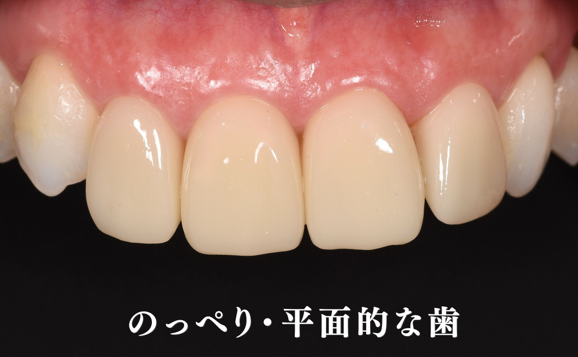 質感が不自然(のっぺり・平面的に見える)