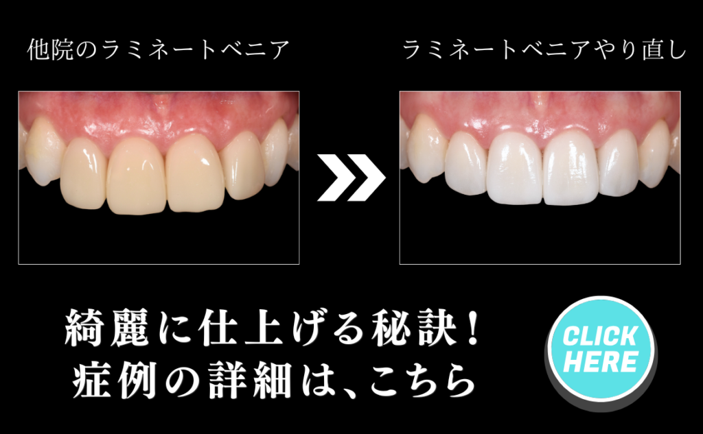 症例はこちら