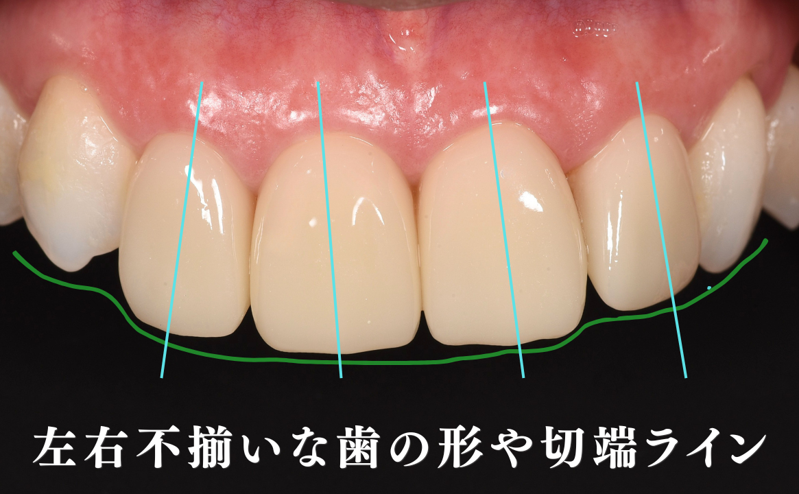 左右差が気になる(長さ/形/色/先端のライン)